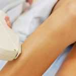 Pros and cons of photoepilator