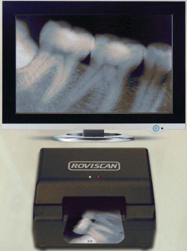 How to scan an X-ray with a regular scanner