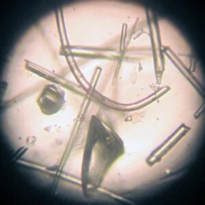 How to get rid of glass wool