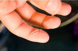 How to remove glass wool from skin